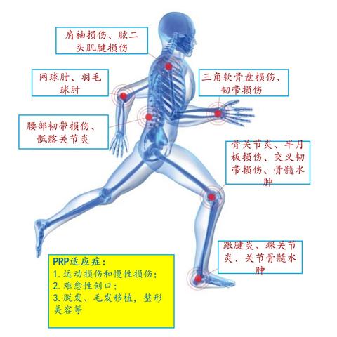 半月板再生术最新进展研究